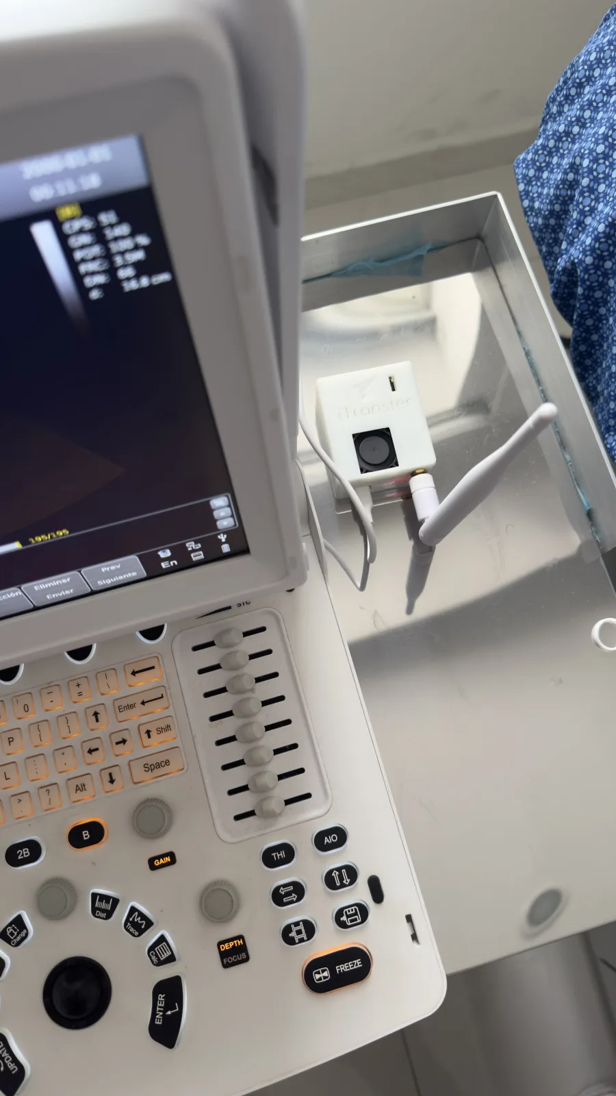 iTransfer connected to a LOGIQ ultrasound system